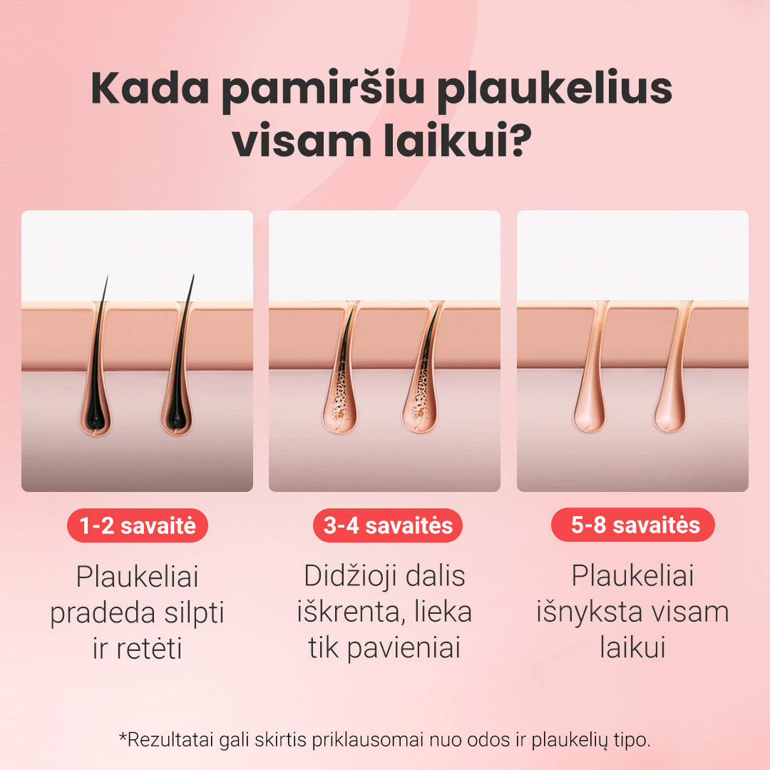 IPL fotoepiliatorius